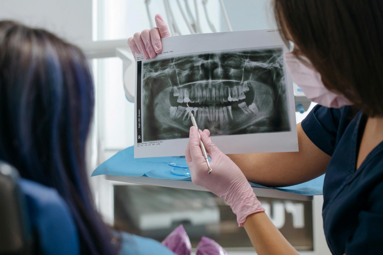 implant-dentar-pret-21.jpg
